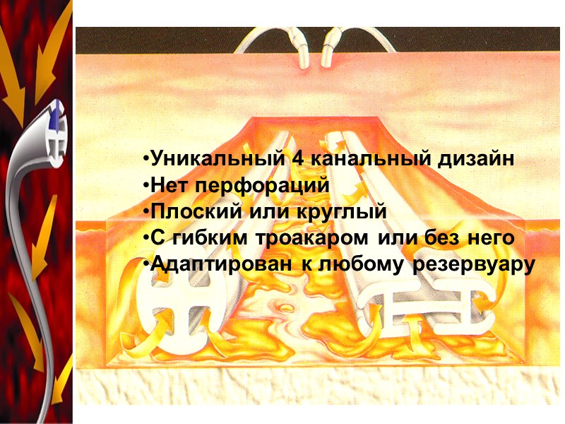 Уникальный 4 канальный дизайн Нет перфораций Плоский или круглый С гибким троакаром или без